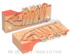 解剖醫(yī)學(xué)模型|牙分解組織模型