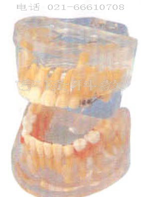 醫(yī)學(xué)模型|透明乳牙發(fā)育模型