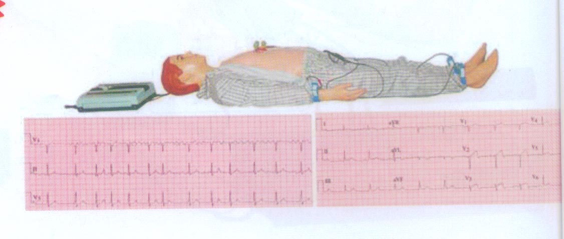 高級(jí)多種心電圖電腦模擬人