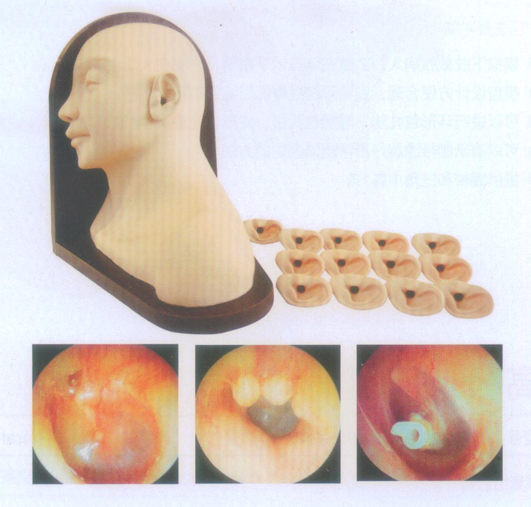 高級耳部檢查模型