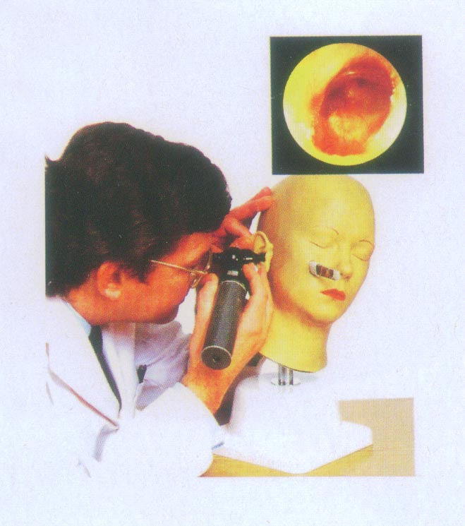 高級耳診斷模型