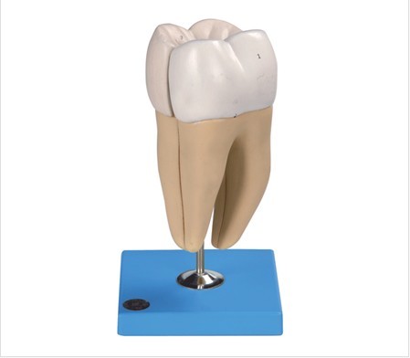 磨牙有兩個(gè)牙根模型