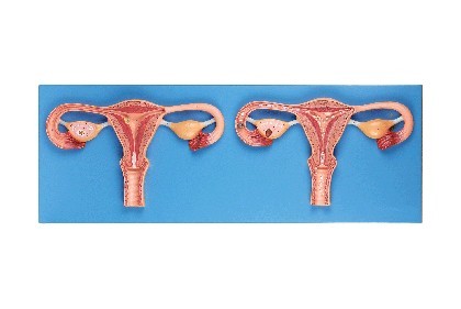 卵子受精過程放大模型