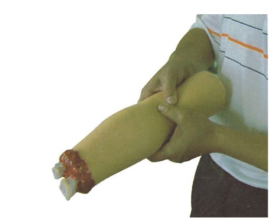 上肢外傷斷肢止血模型