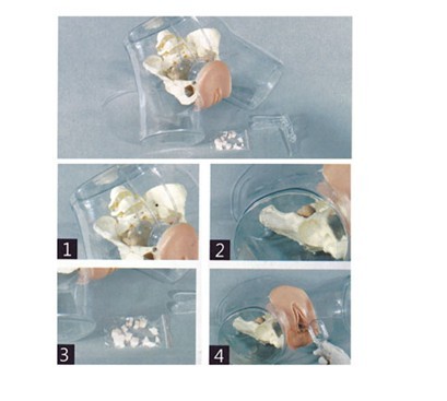 高級透明刮宮模型