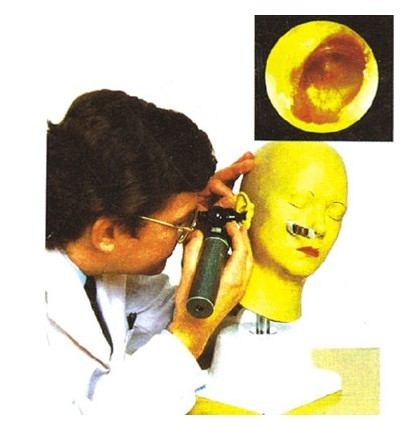 高級(jí)耳診斷模型